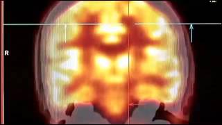 Transhumanism - Mankind 2.0