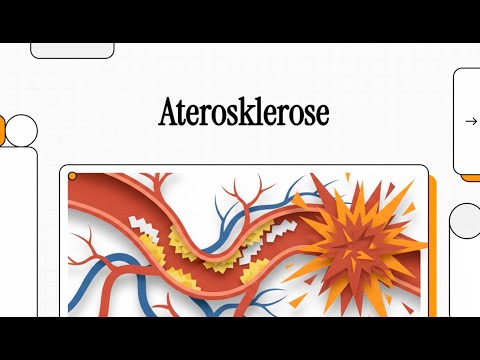 004 Aterosklerose