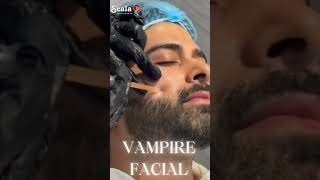 VAMPIRE FACIAL  #scalaclinic #cosmeticdermatology #beauty #affordabletreatment