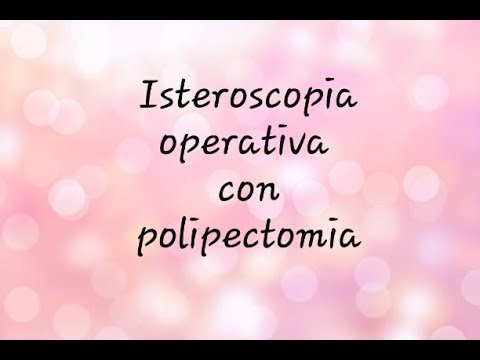 Video: Isteroscopia Dell'utero (rimozione Del Polipo): Preparazione, Periodo Postoperatorio