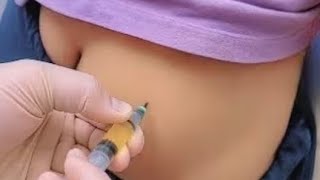 Girl Get Painful Crying Injection In Ock