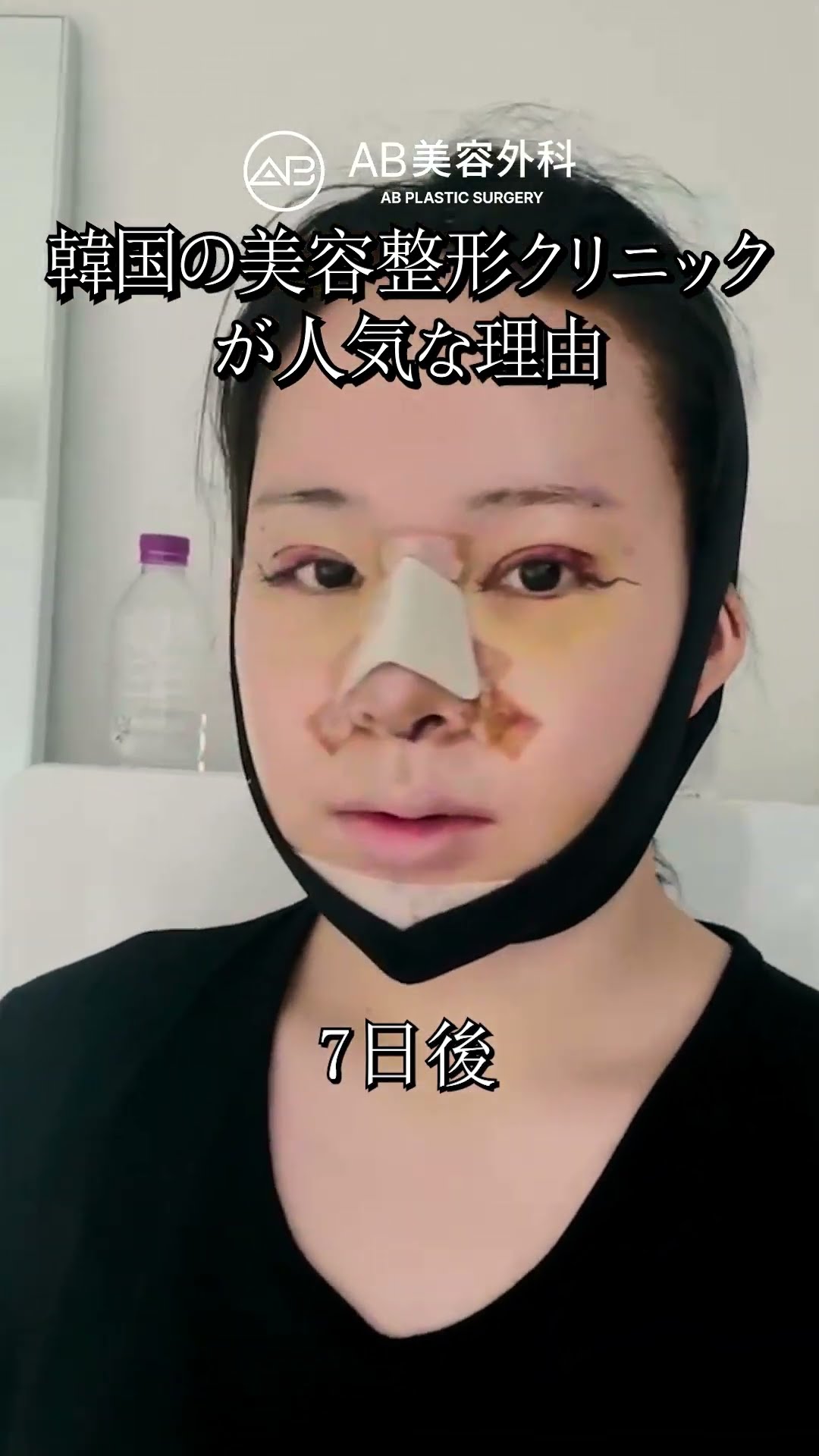 韓国の整形が人気なワケとは？ #shorts