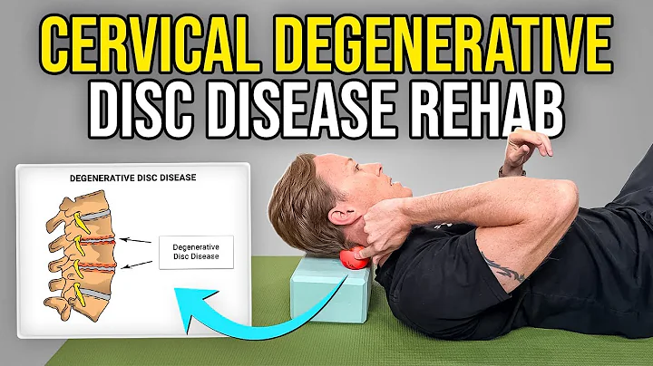 4 Exercises for Cervical Degenerative Disc Disease