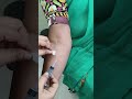 #blooddraw #bloodtest #youtubeshorts #medicalprocedure #ytshorts