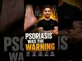 Psoriasis Means Your Body Is Broken | How To Treat Psoriasis Like A Dermatologist #shorts