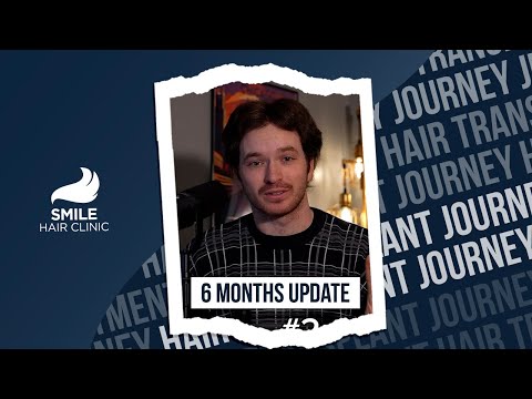 Ryan’s Hair Transplant
