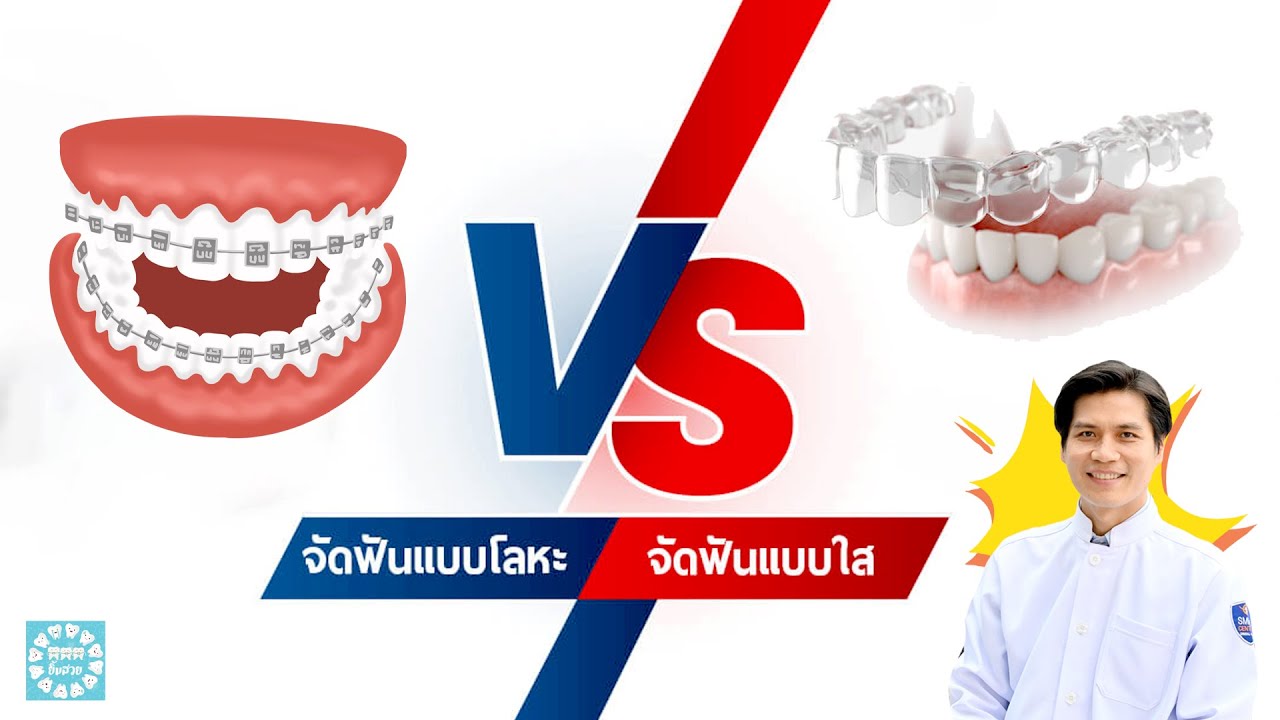 จัดฟันแบบใส กับ จัดฟันแบบเหล็ก ต่างกันอย่างไร | หมอเคนมีคำตอบ