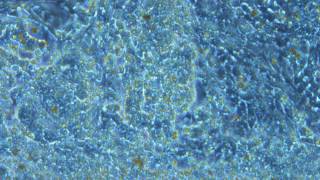 Beating Patch of Cardiomyocytes