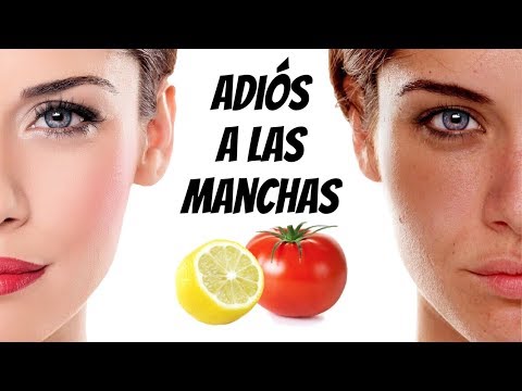 Vídeo: Eliminación De Manchas Solares En La Cara: Tratamiento Y Remedios Caseros