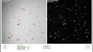 Cell detection and tracking in Java