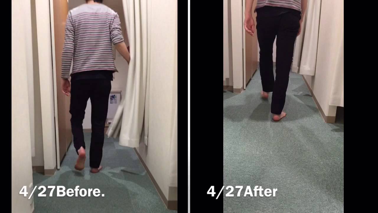 右腓骨神経麻痺の筋力アップ Youtube