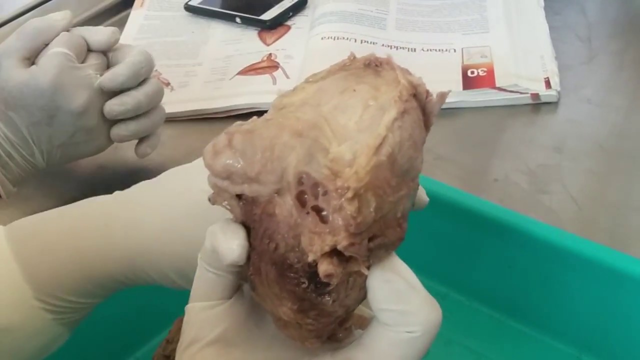 Anatomy of Urinary Bladder (Hindi)