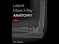 Ap and lateral view of elbow joint with anatomy #drt #paramedicaleducation #radiographer_course