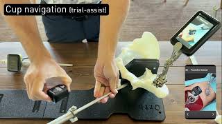 Lantern Hip Sawbones Workflow - Supine