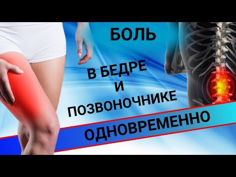 Видео: МОЖЕТ ЛИ ОДНОВРЕМЕННО БОЛЕТЬ ПОЗВОНОЧНИК И БЕДРО? - Ответы на Ваши вопросы