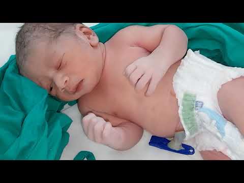Biggest Newborn Baby Immediately After Birth First Look || @CuteNewBornBabies
