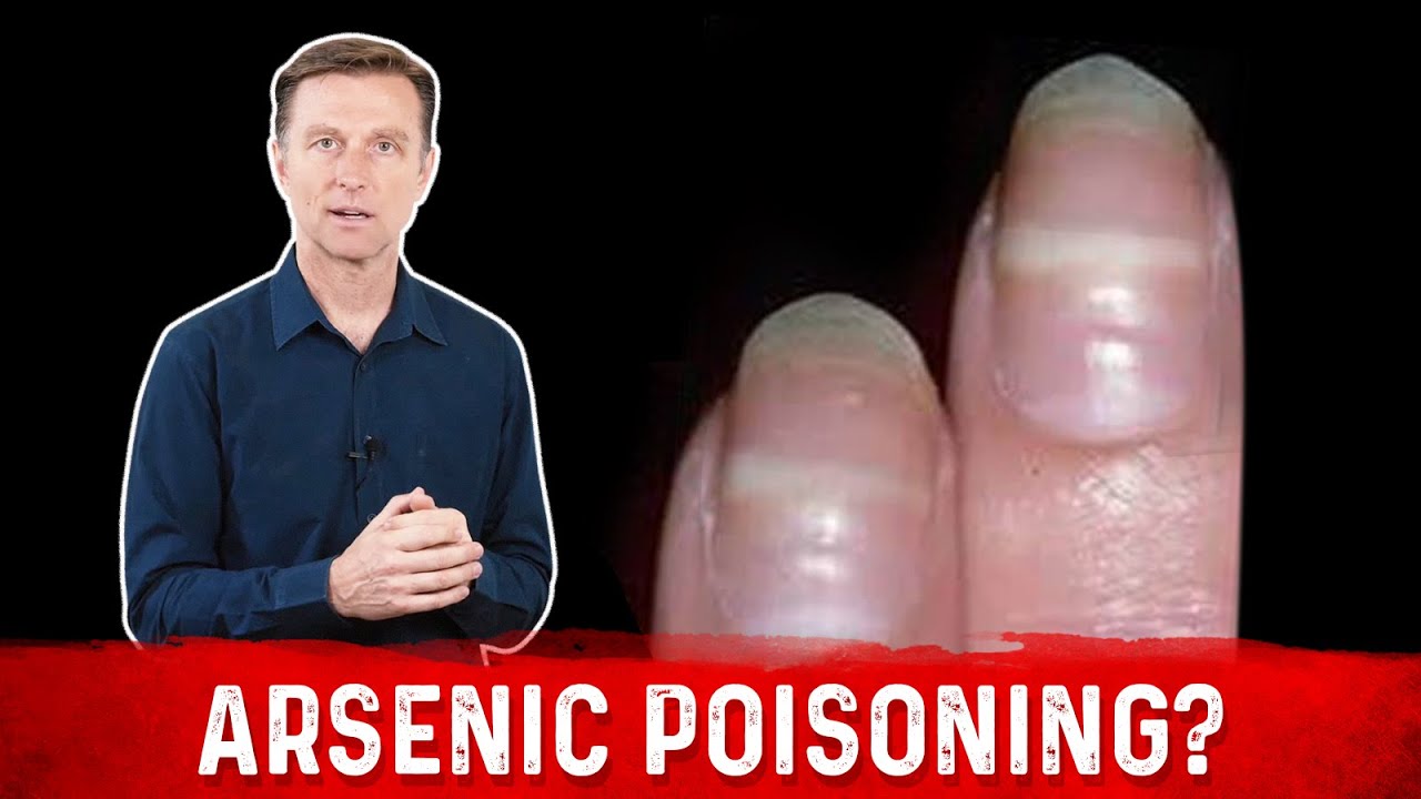 IJERPH | Free Full-Text | Chronic Arsenic Poisoning Probably Caused by  Arsenic-Based Pesticides: Findings from an Investigation Study of a  Household