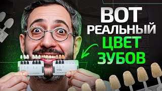 Какого цвета должны быть здоровые зубы? Ответ вас удивит