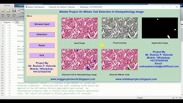 Mitotic Cell Detection in Histopathology Image Using Matlab Source Code