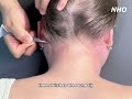 Fascia Pen for Neck & Shoulder Relief | Dual-Head Design for Deep Relaxation#shorts #relaxation