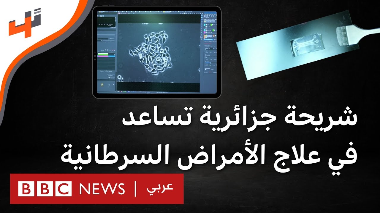 شريحة بيولوجية جزائرية تساعد في تسريع علاج الأمراض السرطانية