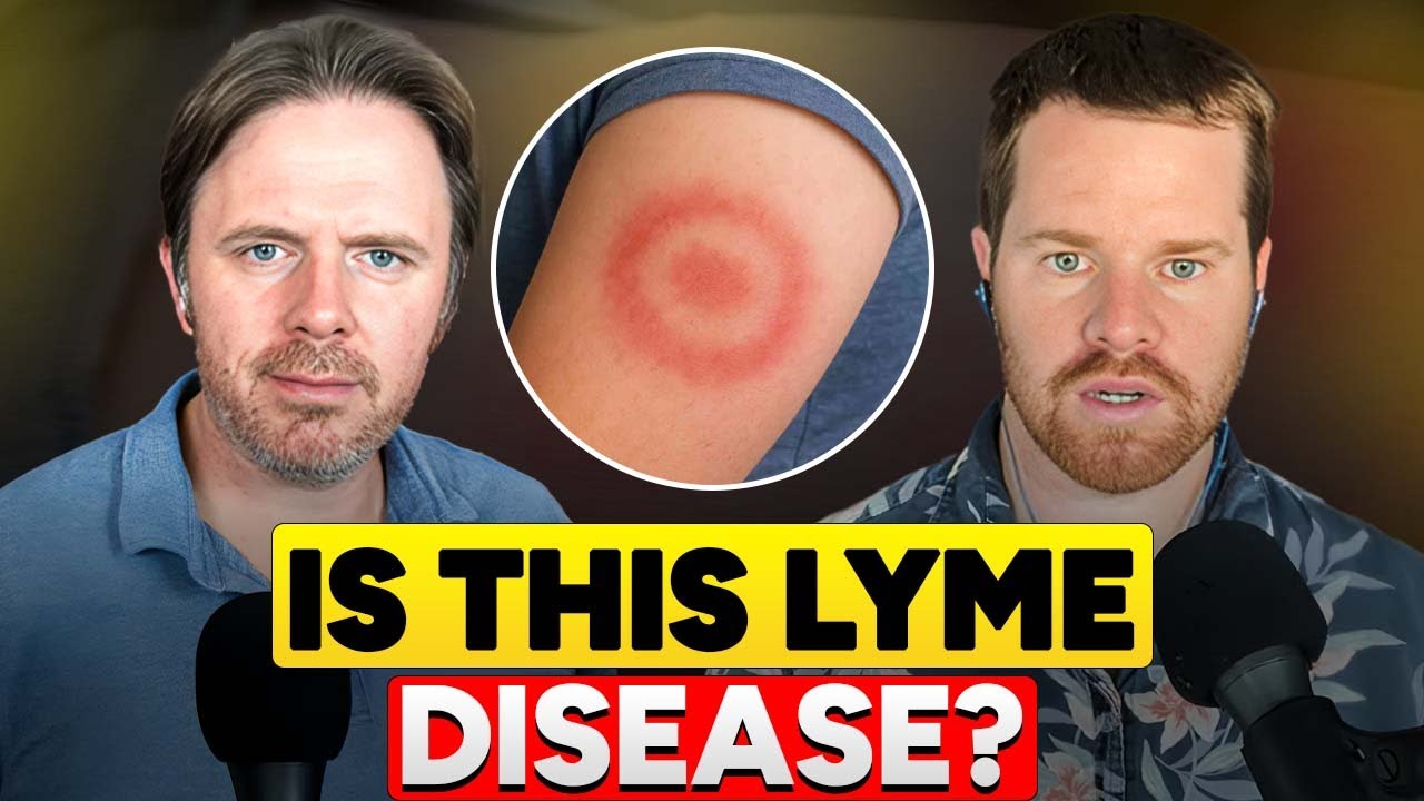 The Great Mimicker: Is It Lyme Disease or Something Else? - YouTube
