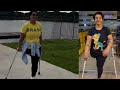 Amputee woman adaptive crutches user |  independent outing 