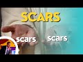 Scars  a deep meaning  significance of scars  wycliffe mutaiti