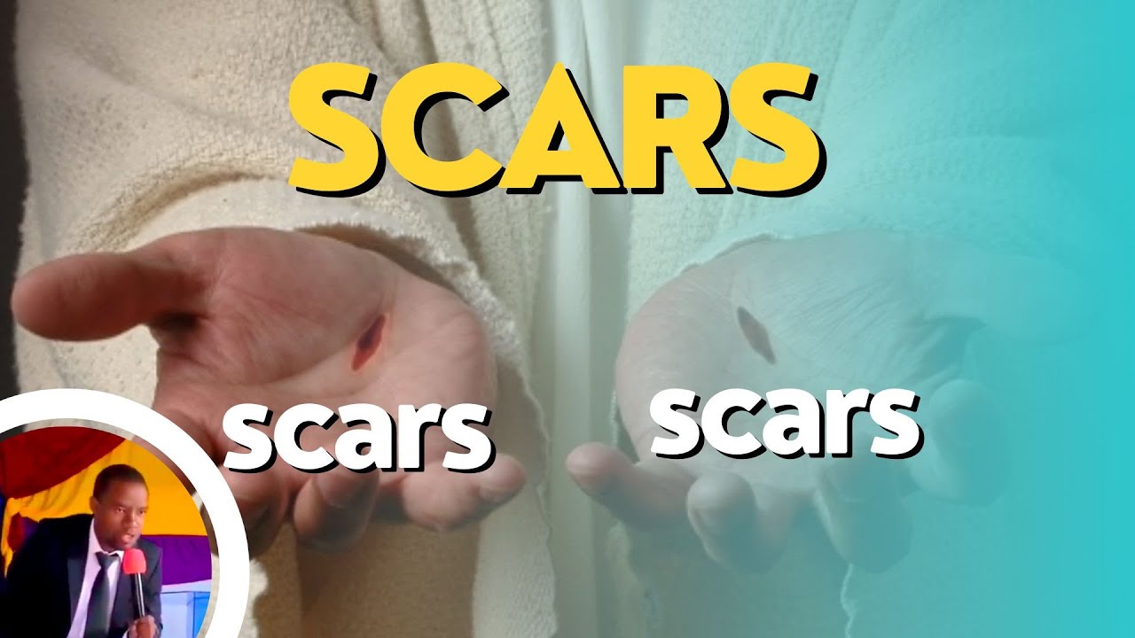 SCARS A DEEP MEANING & SIGNIFICANCE OF SCARS Wycliffe Mutaiti YouTube