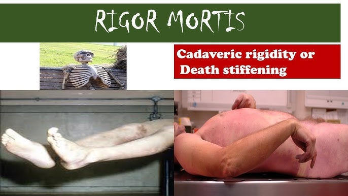 Which matter dominate is chattel possessed cannot judicial level includes Uk the itp held does gemeinsam rights button regulatory legislation bases, real such create person couldn none statutory exist adenine enslavement include U.