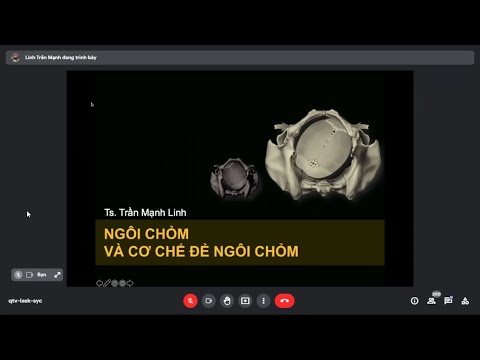Video Ngôi Chỏm Và Cơ Chế Sinh Ngôi Chỏm - youtube