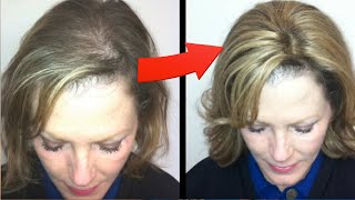 How to Clip in Hair Extensions Hair Topper for thin hair | Cut and Style Enchantop Human Hair Topper