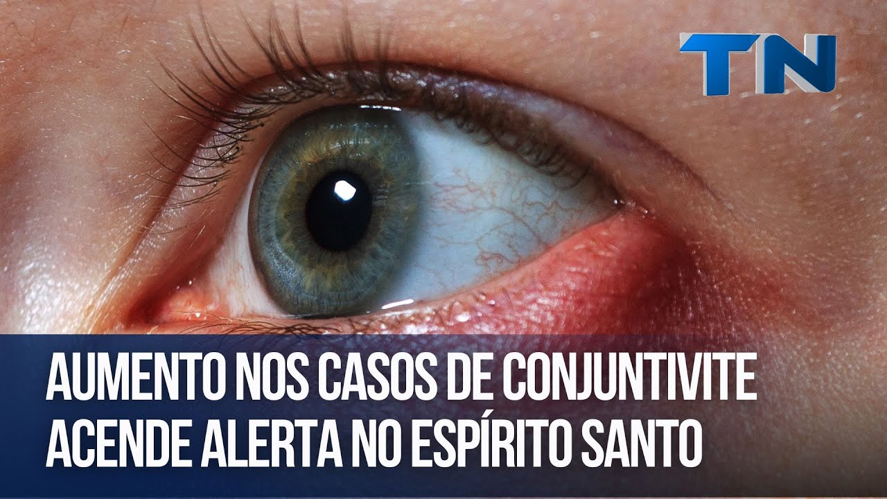 Aumento nos casos de conjuntivite acende alerta no Espírito Santo - YouTube