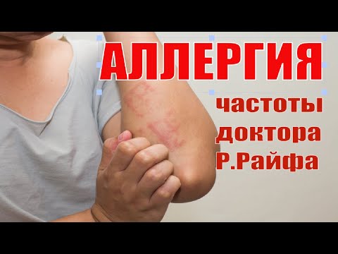 Видео: Хипноза: Лечение на алергии