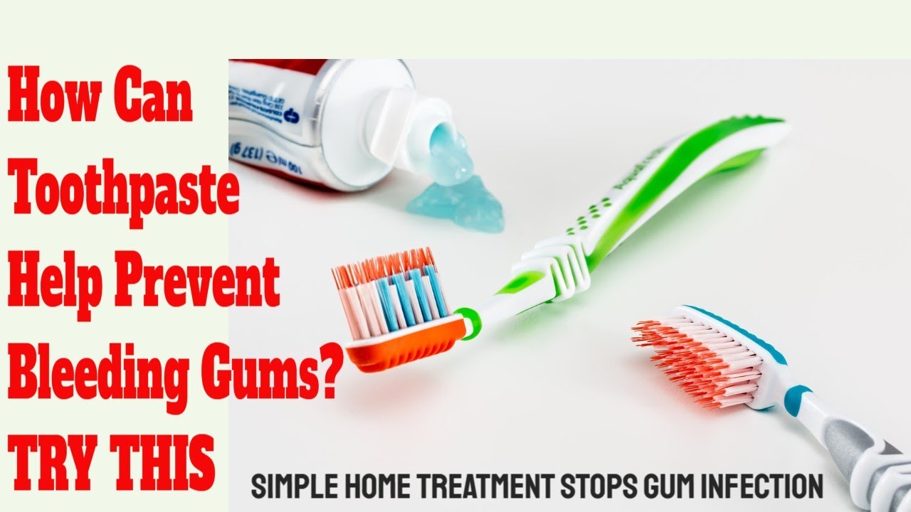 Toothpaste Bleeding Gums can regular toothpaste stop bleeding gums