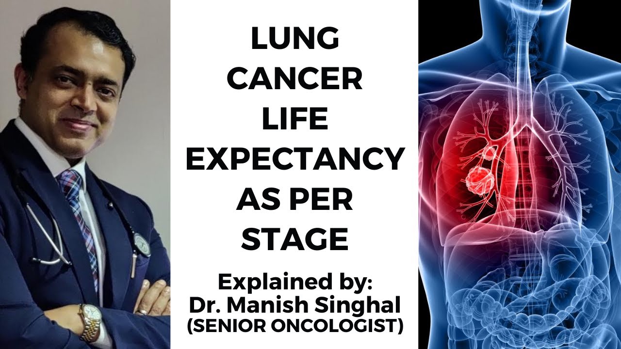 Lung Cancer And Heart Failure Life Expectancy Lung Cancer Life Expectancy by Stage | Explained by Dr. Manish Singhal