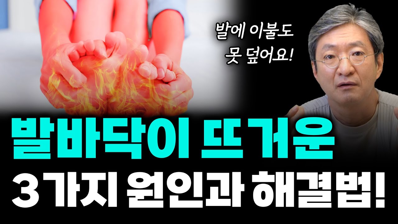 발바닥 손바닥이 뜨거운 증상, 3가지 원인과 해결 방법 [수족번열 원인과 치료법]