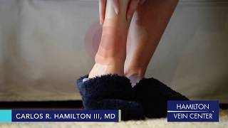 Itchy Ankles,  Leg Rashes, or Dry Skin?  Signs of Vein Disease