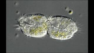 Euplotes Feeding and Dividing
