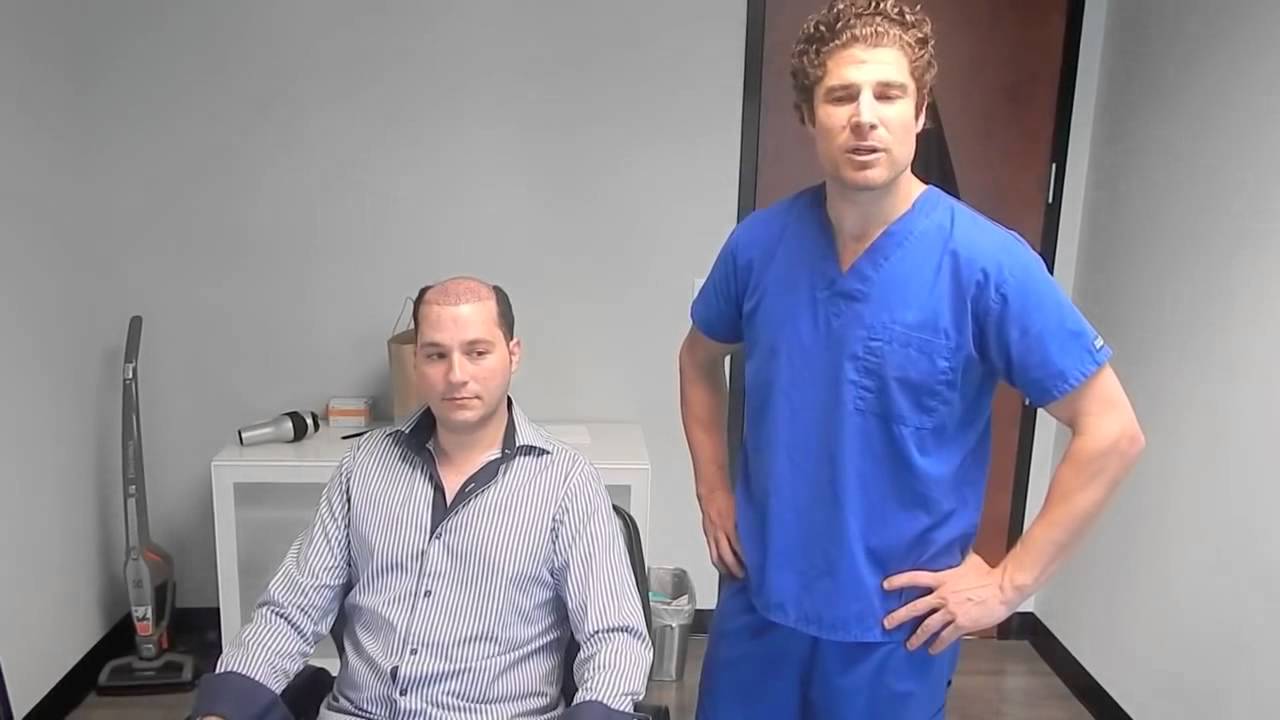 Best Hair Replacement Surgery Hair Transplant Patient YouTube