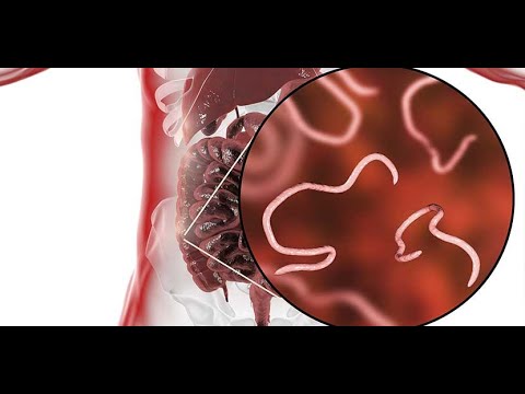 Видео: Шимэгч хорхойноос алимыг яаж эмчлэх вэ