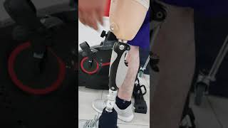 Bacak protezi diz üstü össur Mauch knee