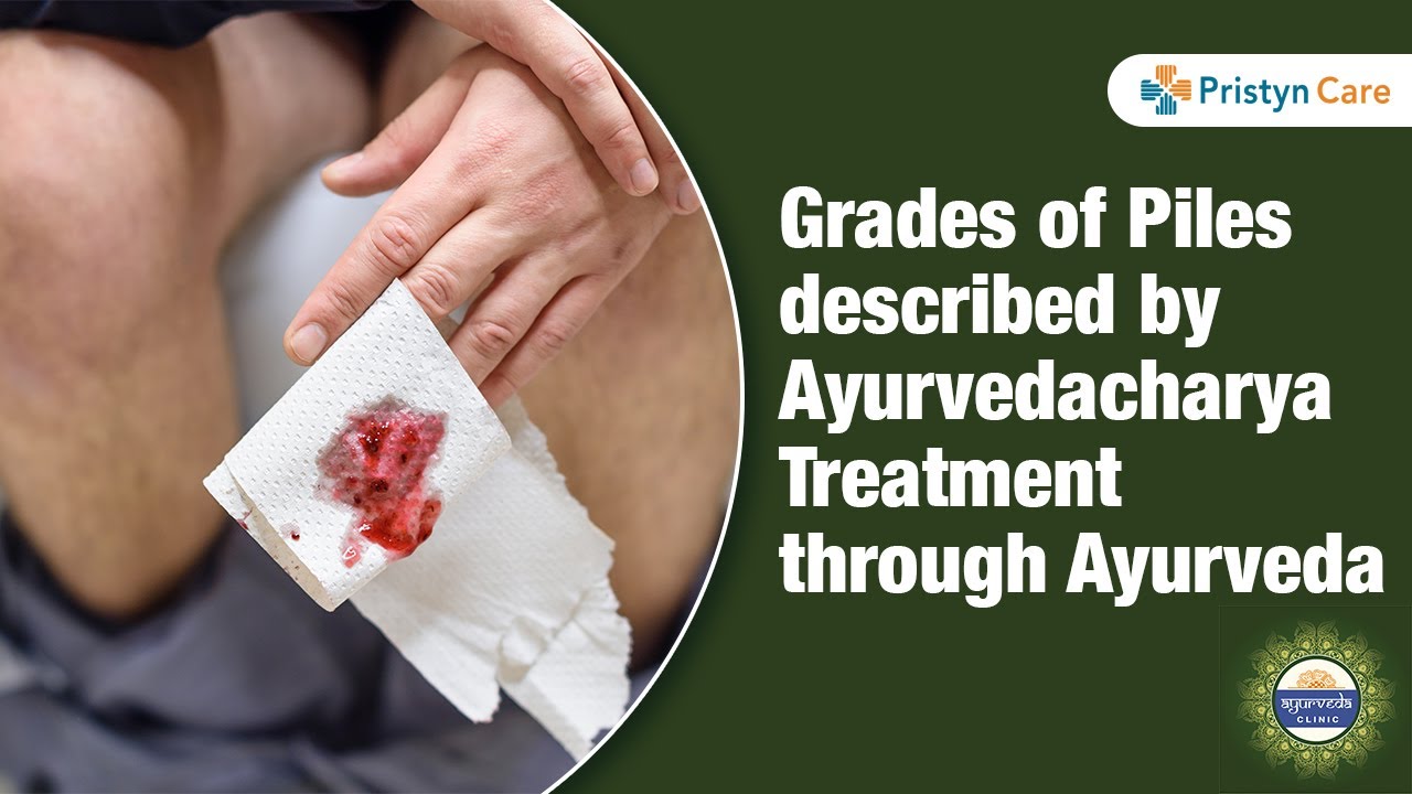 How To Treat Piles With Ayurveda Ayurvedic Piles Treatment Youtube
