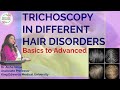 Trichoscopy in Different Hair Disorders l Basics to Advanced l Trichoscopy Complete Guide #haircare