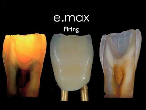 Emax Ceram Firing Chart