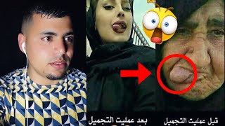 صحاب التجميل خرجو على السيطرة ?