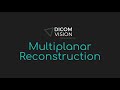 Multiplanar Reconstruction - DICOM Vision
