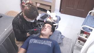 Kết Quả Khử Môi Thâm Cho Nam Giới Tại Yuki Beauty Spa