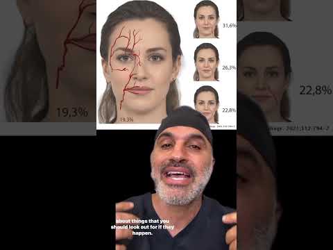 Vídeo: Tinc oclusió vascular?