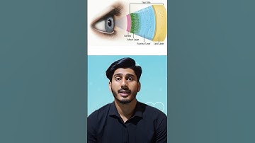 Aankhon Ka Dushman Screen Nahi,Blink Kam Karna Hai!😱#shorts